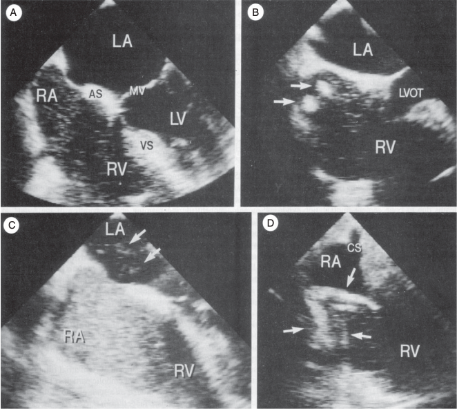 查看图片需登陆