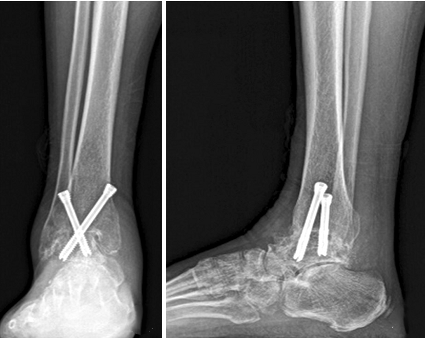 查看图片需登陆