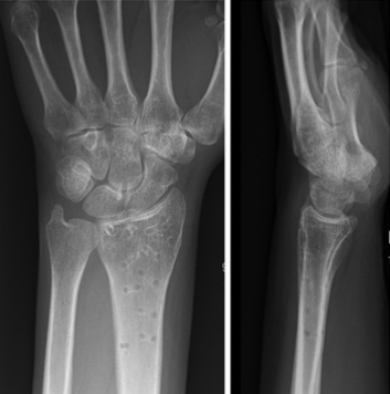 查看图片需登陆