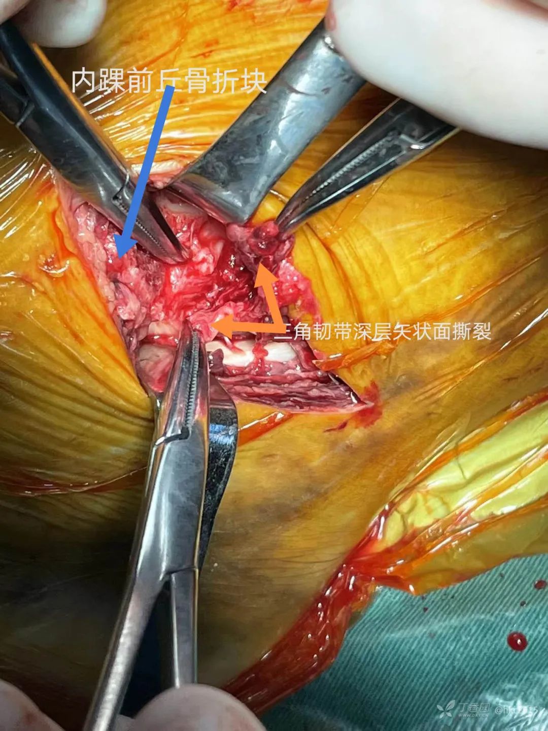 查看图片需登陆