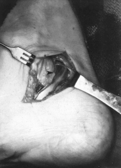 查看图片需登陆