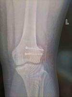 查看图片需登陆