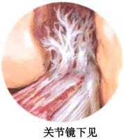 查看图片需登陆