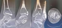 查看图片需登陆