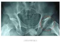 查看图片需登陆