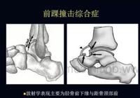 查看图片需登陆