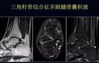 查看图片需登陆
