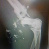 查看图片需登陆