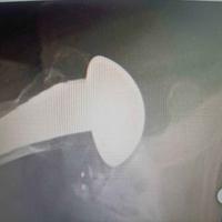 查看图片需登陆