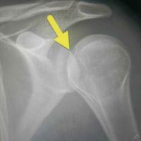 查看图片需登陆