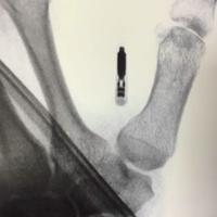 查看图片需登陆