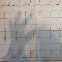 查看图片需登陆