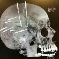 查看图片需登陆