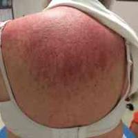 查看图片需登陆