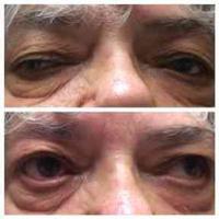 查看图片需登陆