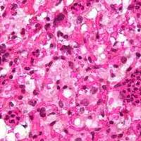 查看图片需登陆