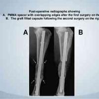 查看图片需登陆