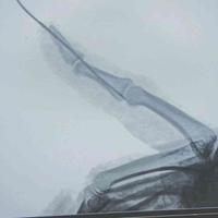 查看图片需登陆