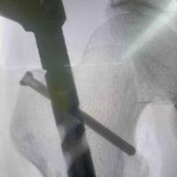 查看图片需登陆