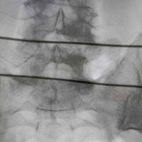 查看图片需登陆