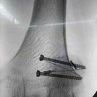 查看图片需登陆