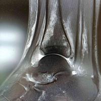 查看图片需登陆