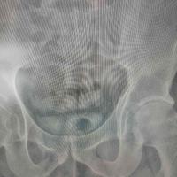 查看图片需登陆