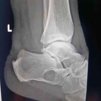 查看图片需登陆