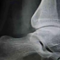 查看图片需登陆