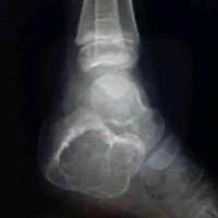 查看图片需登陆