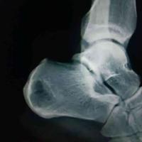 查看图片需登陆