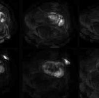 查看图片需登陆