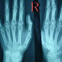 查看图片需登陆