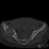 查看图片需登陆