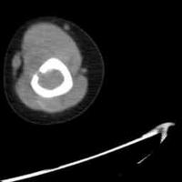 查看图片需登陆