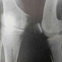 查看图片需登陆