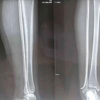 查看图片需登陆