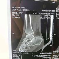 查看图片需登陆