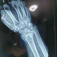 查看图片需登陆