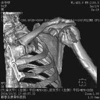 查看图片需登陆