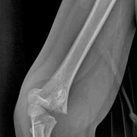 查看图片需登陆