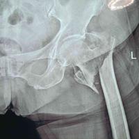 查看图片需登陆