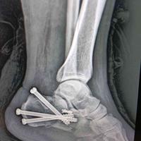 查看图片需登陆