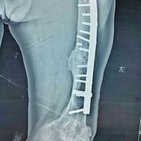 查看图片需登陆